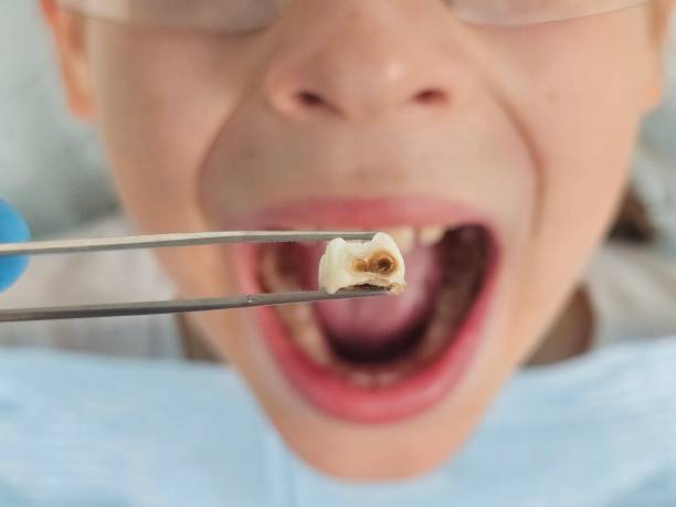 Best Walk-In Emergency Dentist in Ormond By The Sea, FL